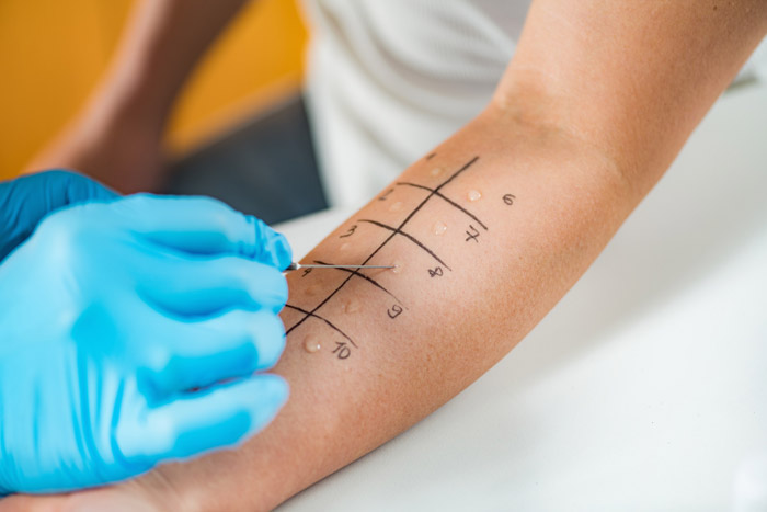 Allergology Specialization Training Program (For European Resident Physicians Only)