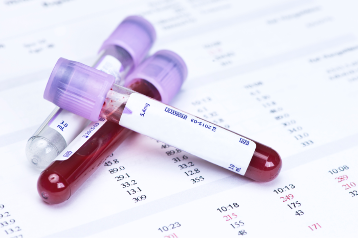 Hematology Specialization Training Program (For European Resident Physicians Only)